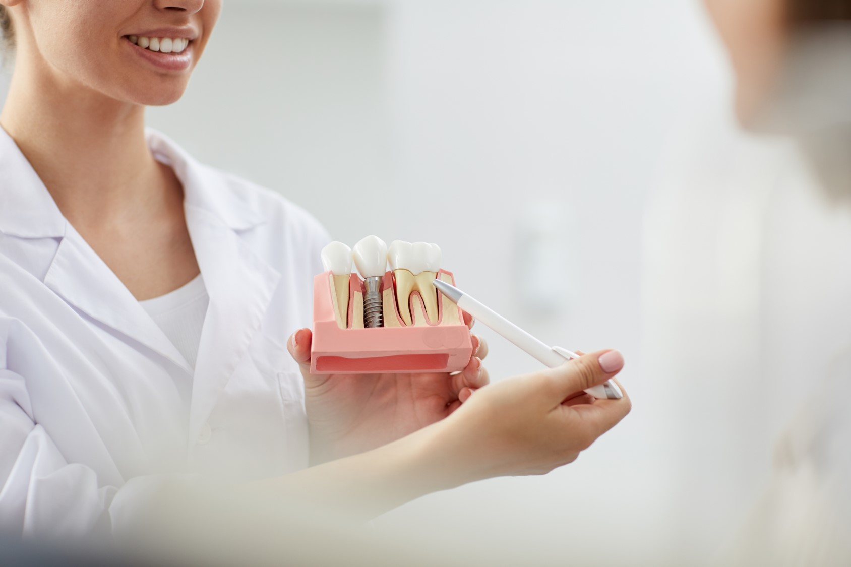 Όσα πρέπει να ξέρετε για τα οδοντικά εμφυτεύματα